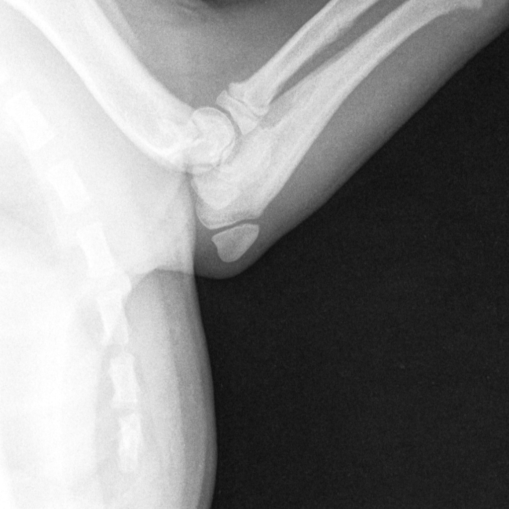 An X-ray of Tony's injury